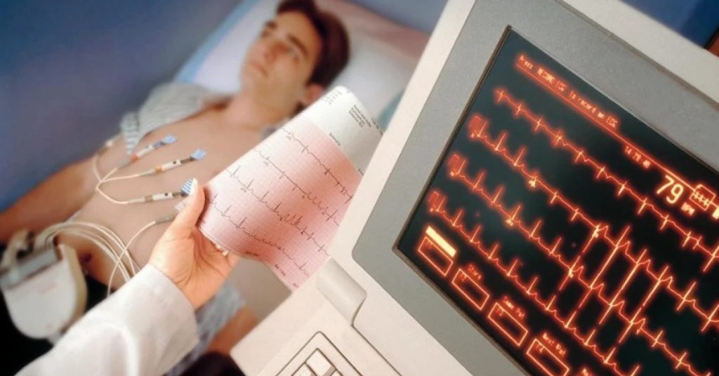 ECG
